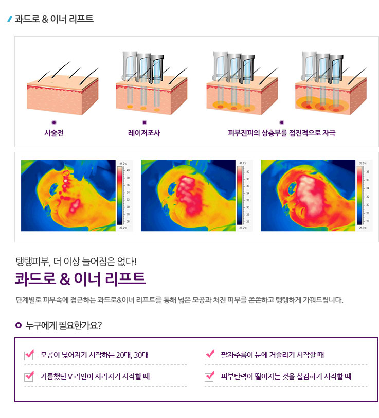 콰드로_이너리프트