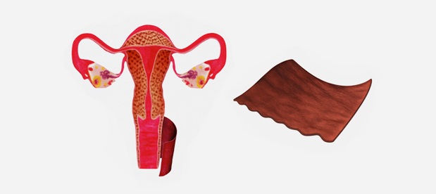 러브미여성의원 벨라도나 치료 원리