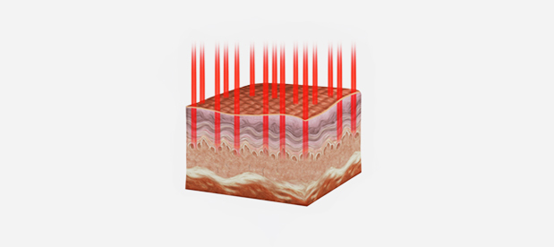 러브미여성의원 벨라도나 치료 원리