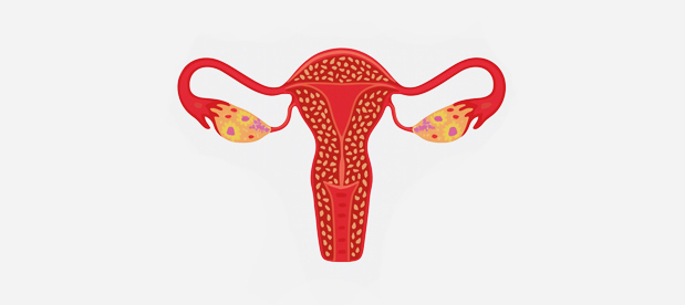 러브미여성의원 벨라도나 치료 원리